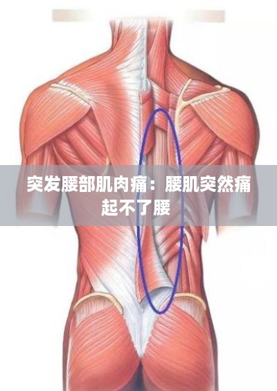 突发腰部肌肉痛：腰肌突然痛起不了腰 