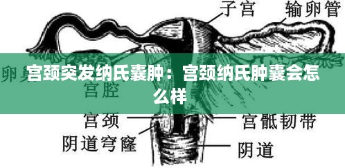 宫颈突发纳氏囊肿：宫颈纳氏肿囊会怎么样 