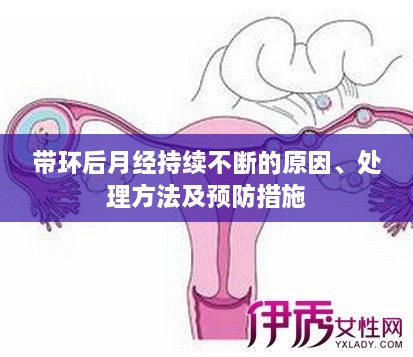 带环后月经持续不断的原因、处理方法及预防措施