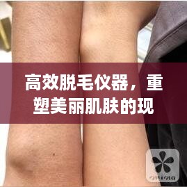 高效脱毛仪器，重塑美丽肌肤的现代科技之选